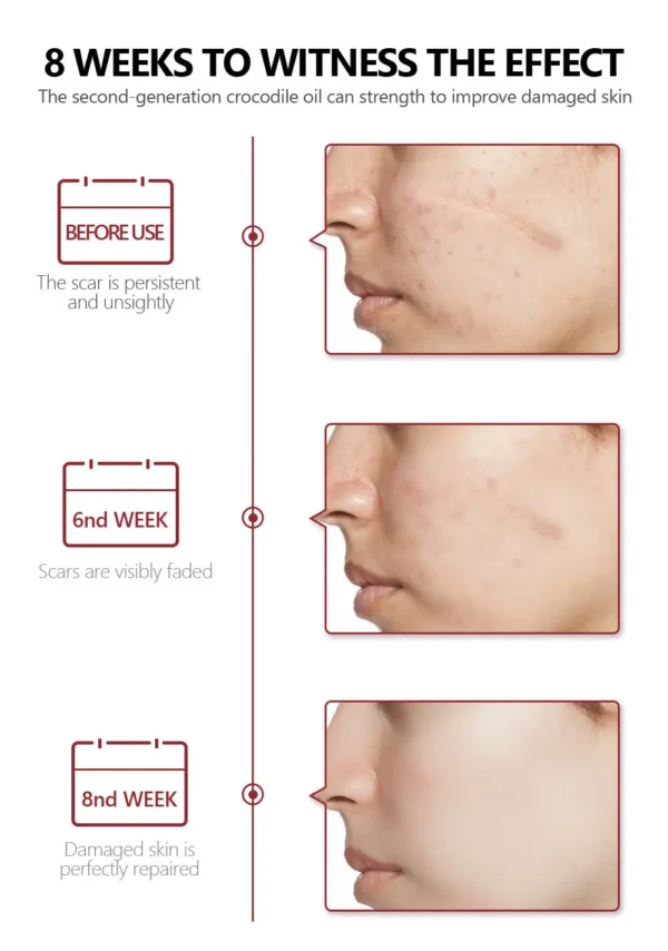 Face Spot Remover & Skin Repair Serum Acne, Keloid & Scar Healing Treatment (1.02 fl oz) - Image 2